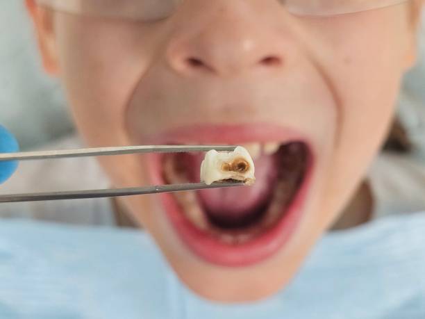Best Broken or Chipped Tooth Repair in Pepeekeo, HI